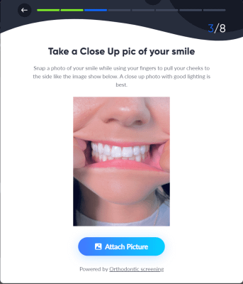 step 2 take close up of your teeth